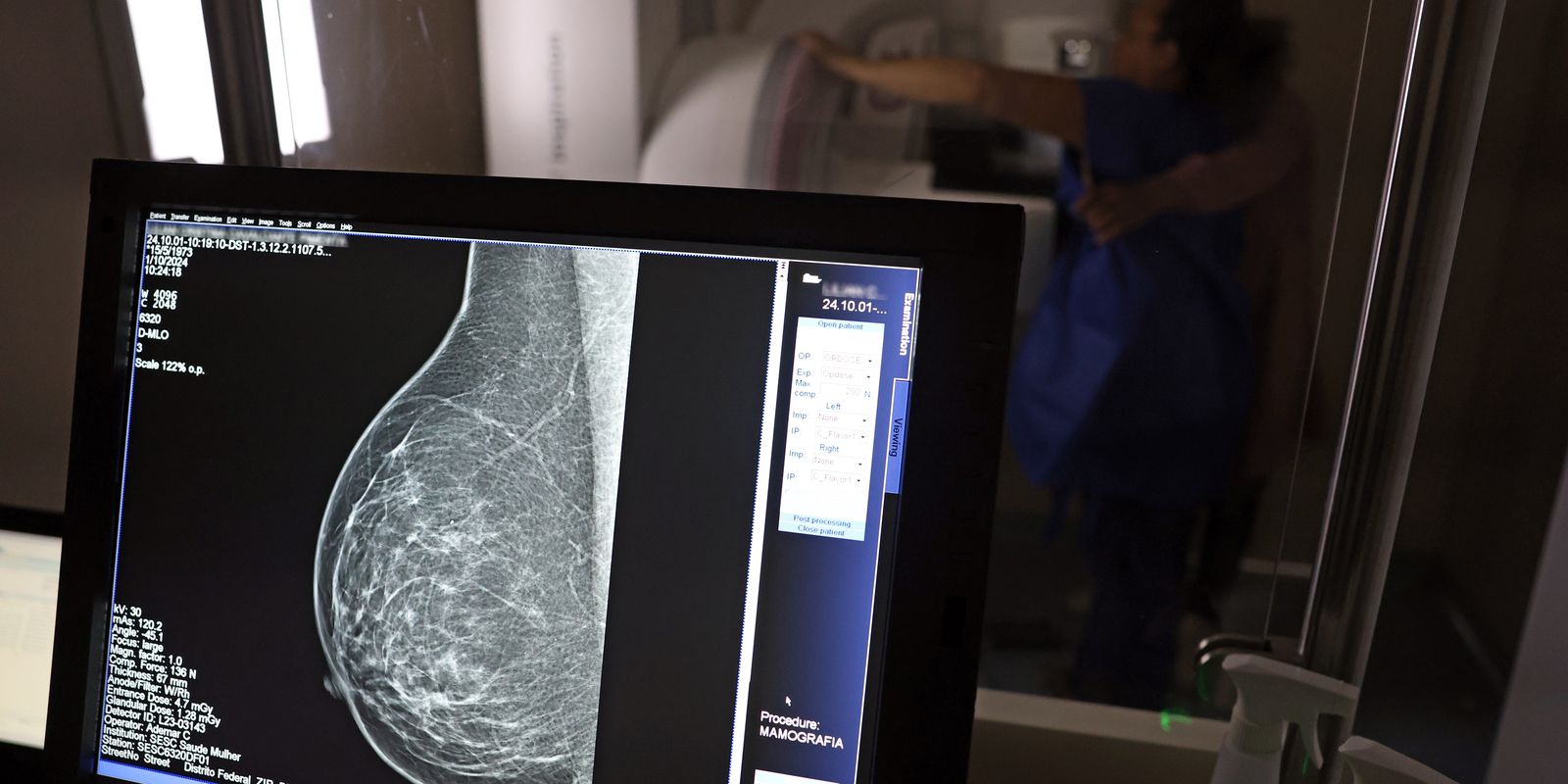 Dia da Mamografia reforça sobre necessidade de ampliar acesso ao exame