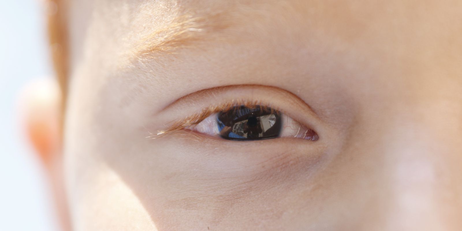 “Dezembro Dourado” chama atenção para casos de cegueira infantil