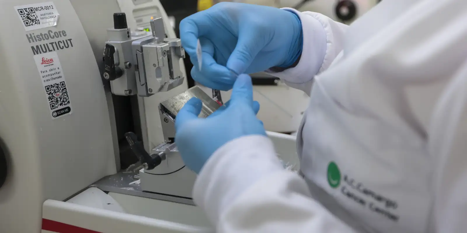 Cirurgia robótica para câncer de próstata é incorporada ao SUS