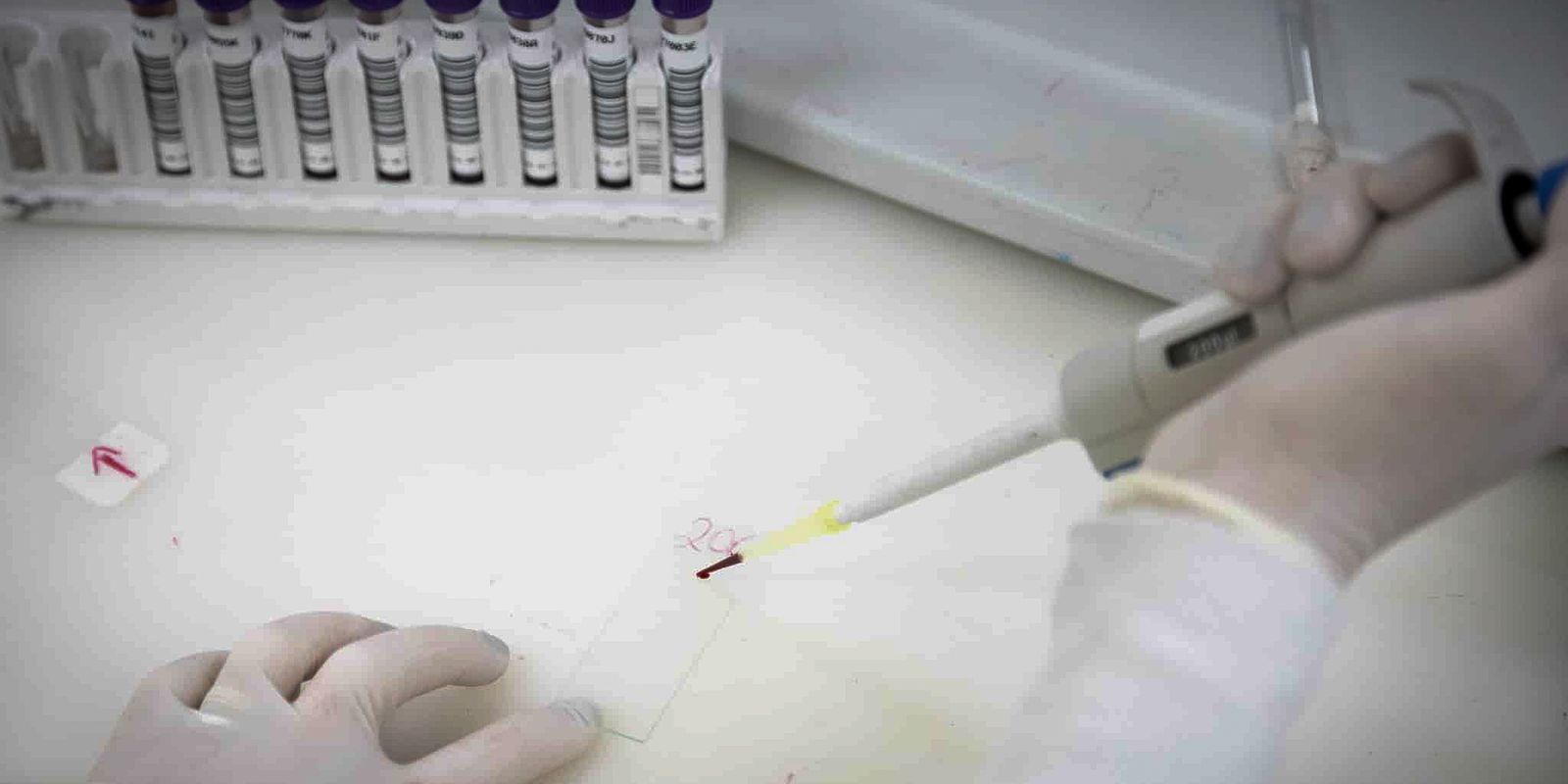Exames descartam vírus ebola em pacientes com suspeita no Rio e em SP