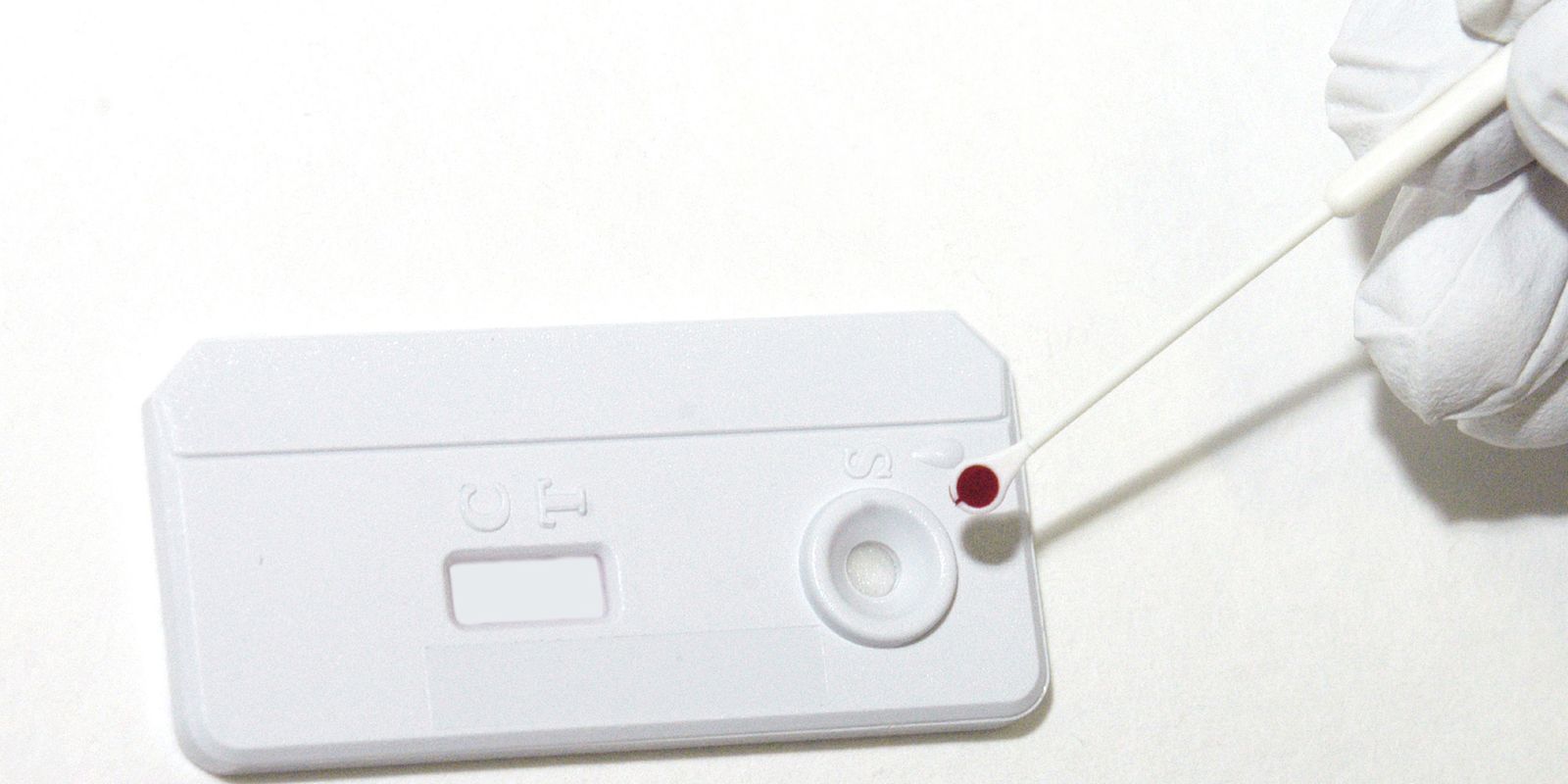 OMS divulga relatório de enfrentamento ao HIV, hepatites virais e ISTs