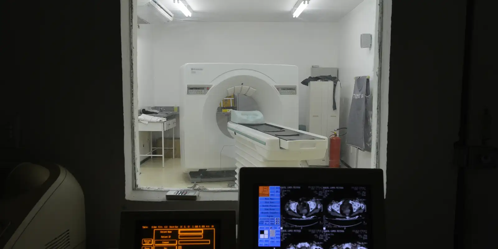 Entenda o limite seguro de radiação em exames de imagem