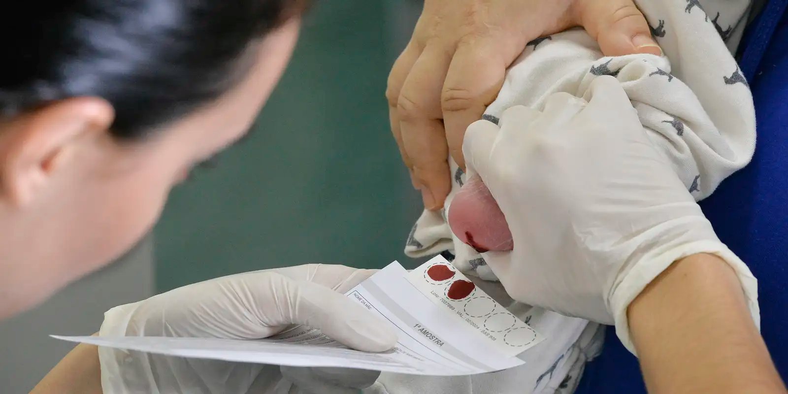 Setembro Roxo alerta para a fibrose cística, a doença do beijo salgado