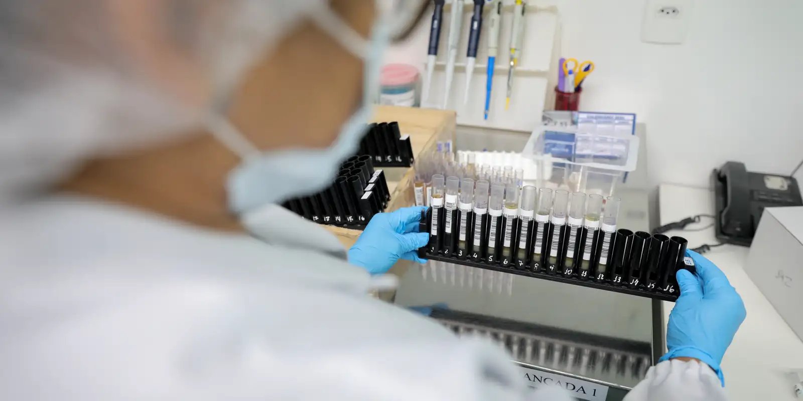 Vacina brasileira contra malária avança para testes em humanos